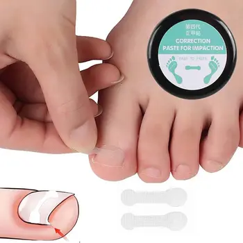 Инструменти за педикюр Паронихия Ортопедични таблетки за корекция на ноктите Стикер за корекция на ноктите на краката Орто стикер Врастнали нокти на краката стикери